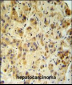FUCA1 Antibody (Center)